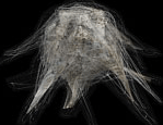 Spider egg